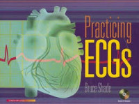 Image of Practicing ECGs