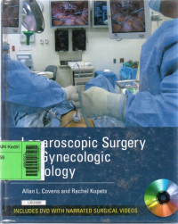 Image of Laparoscopuc surgery for gynecologic oncology